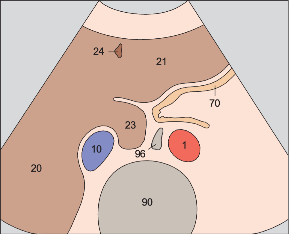 Passage of aorta and vena cava through diaphragm