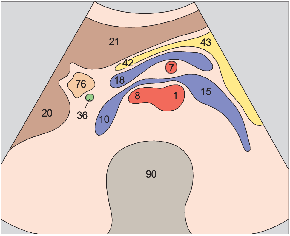 Left renal vein and right renal artery