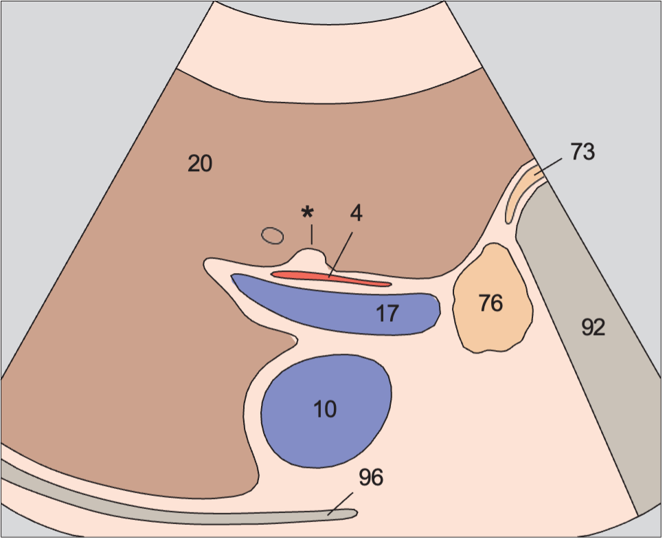 Right portal vein branch, ligamentum venosum