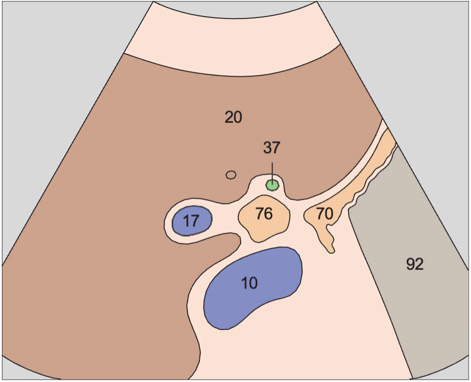 Gallbladder neck