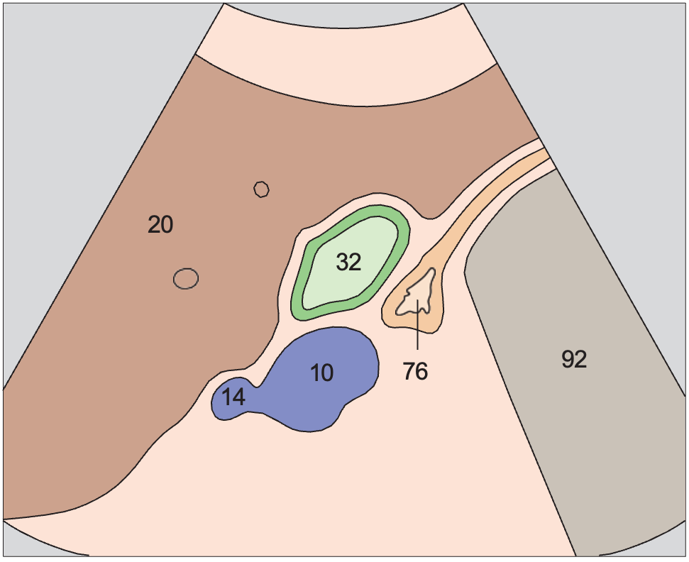 Body of gallbladder