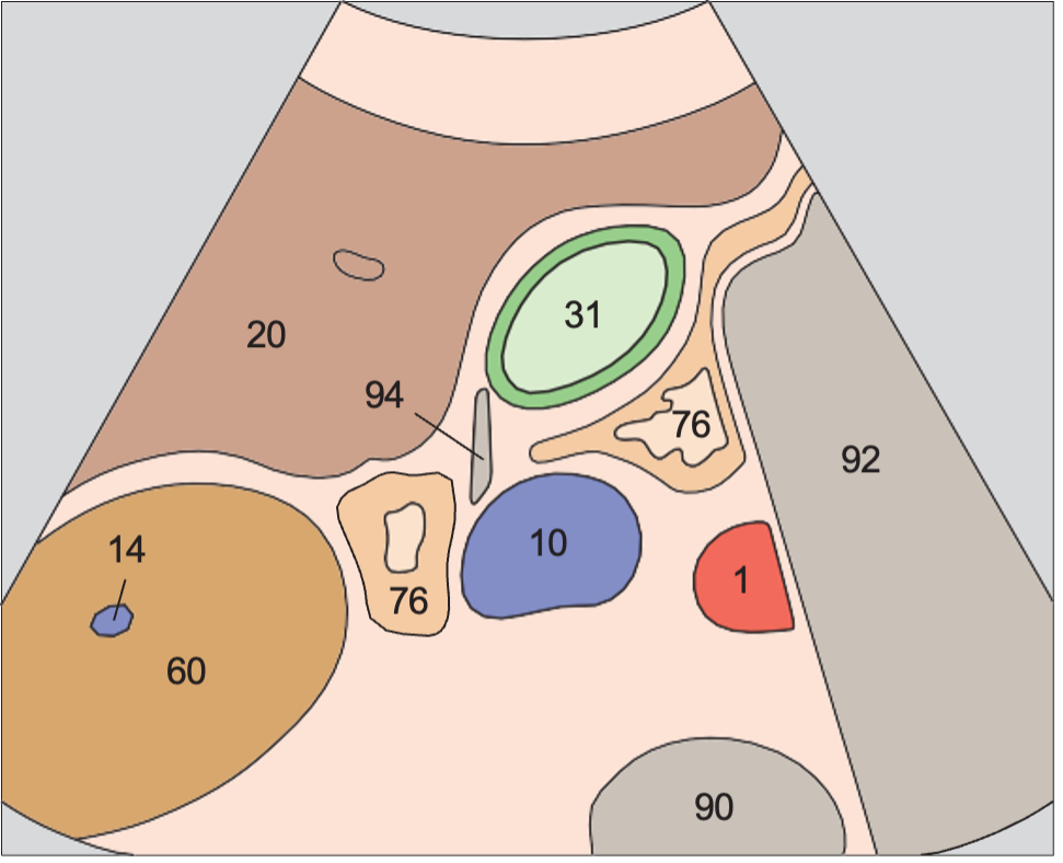 Gallbladder fundus