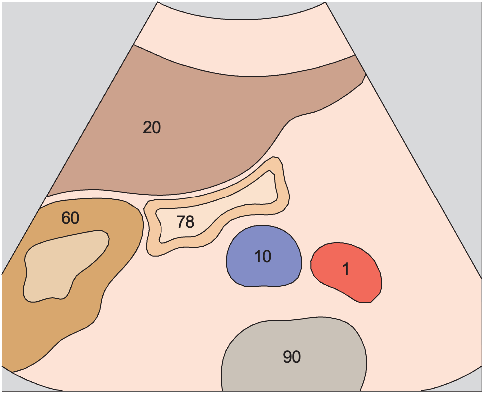 Gallbladder fundus, inferior border