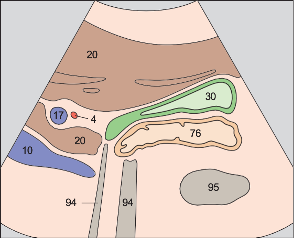 Right portal vein branch, body and neck of gallbladder