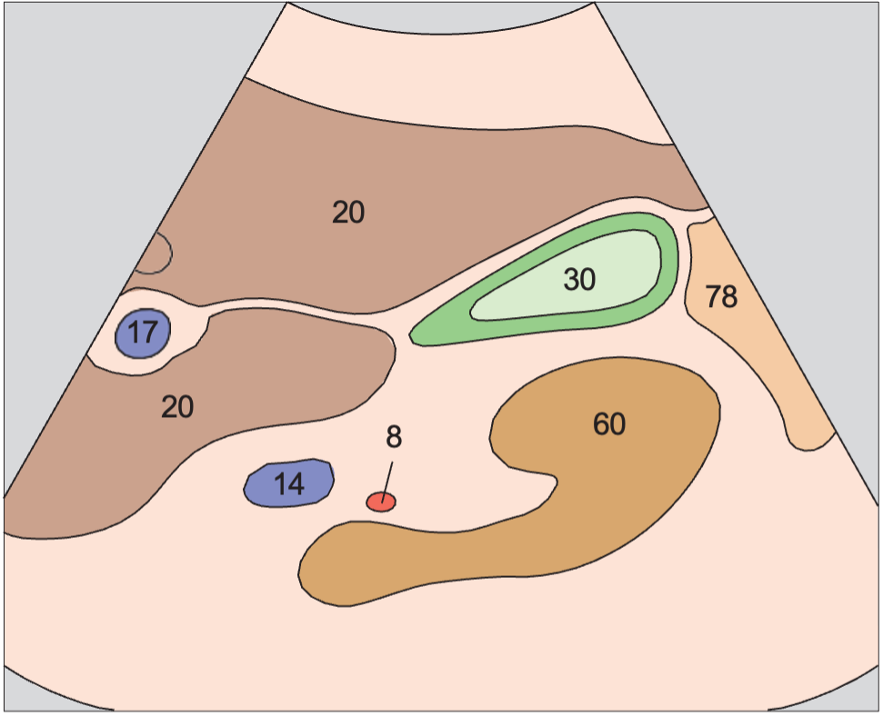 Body and fundus of gallbladder, kidney
