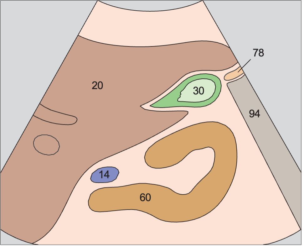 Gallbladder fundus, kidney