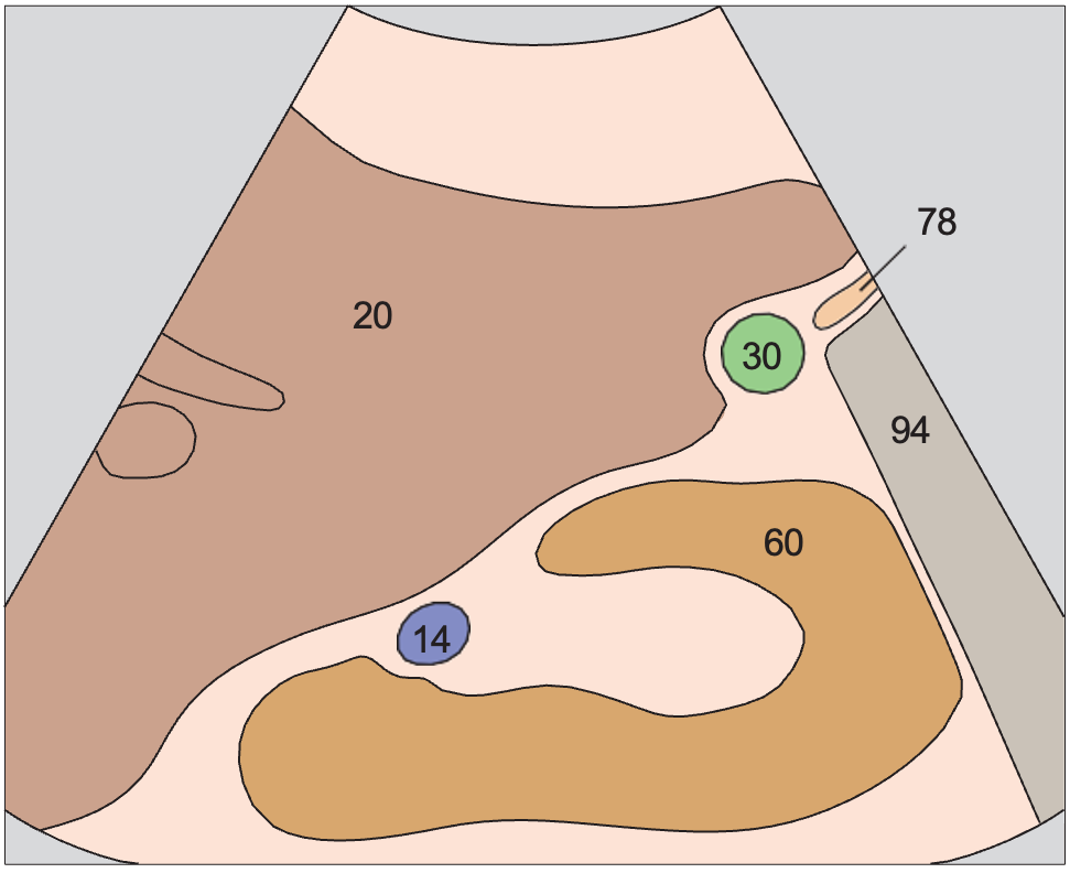 Gallbladder fundus, kidney