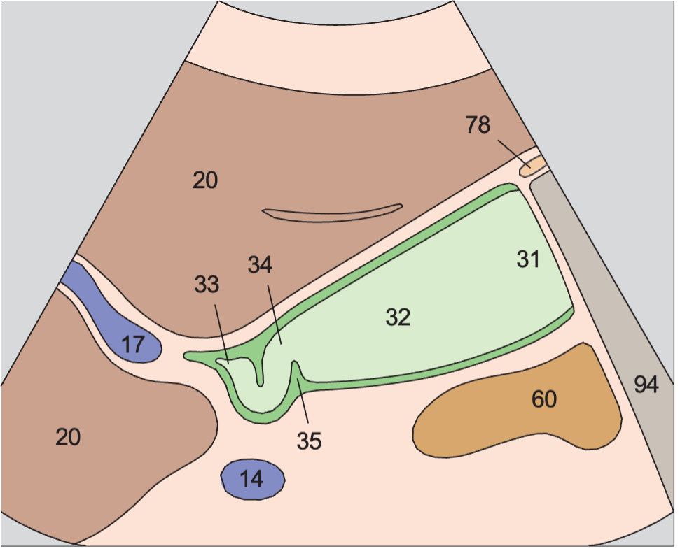 Regions of the gallbladder, spiral folds