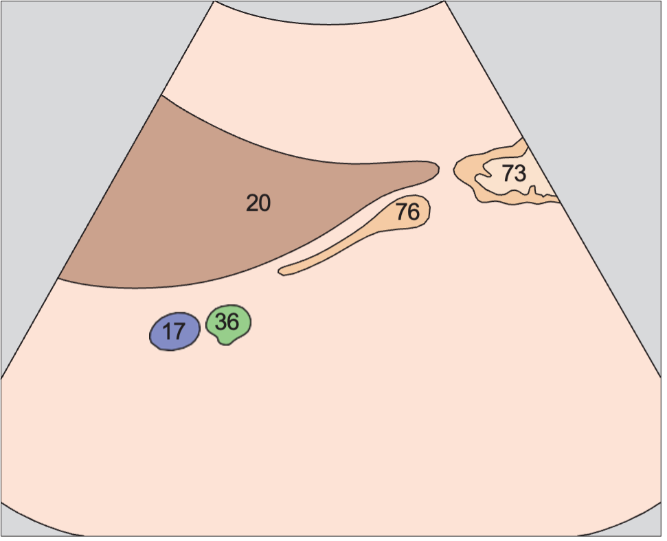 Duodenum lateral to head of pancreas
