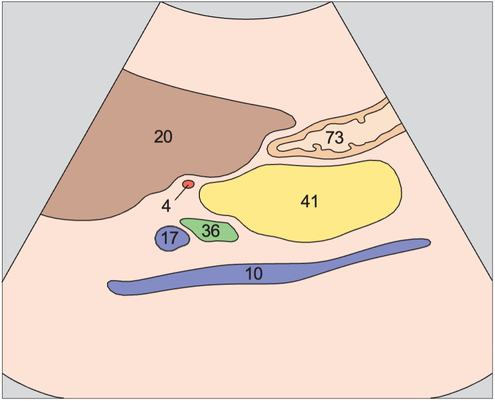 Head of pancreas, bile duct