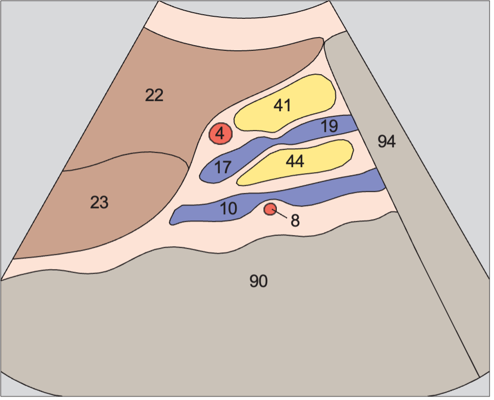 Head of pancreas, superior mesenteric vein, uncinate process