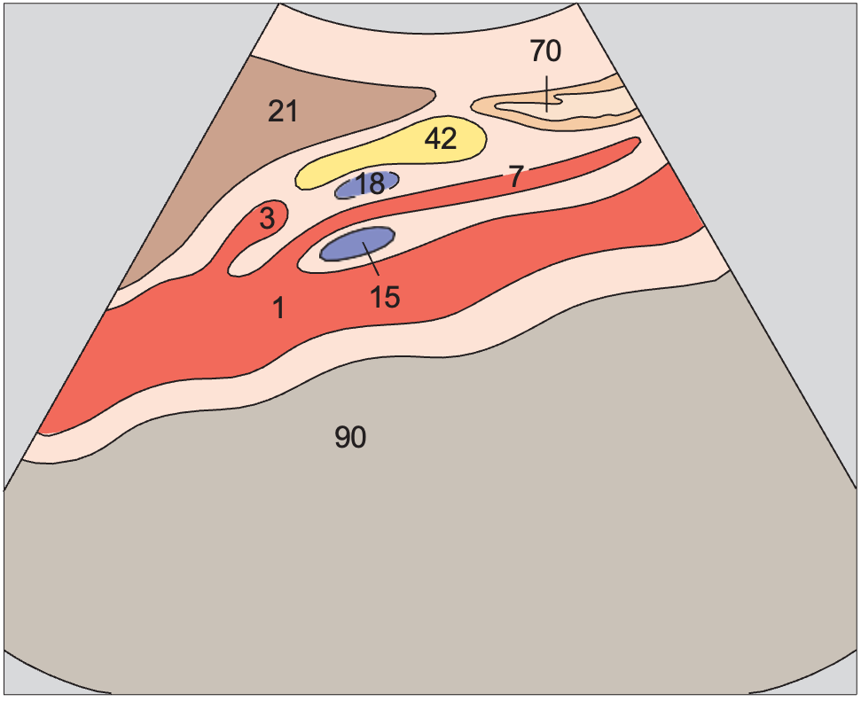 Body of pancreas, splenic vein, superior mesenteric artery, aorta