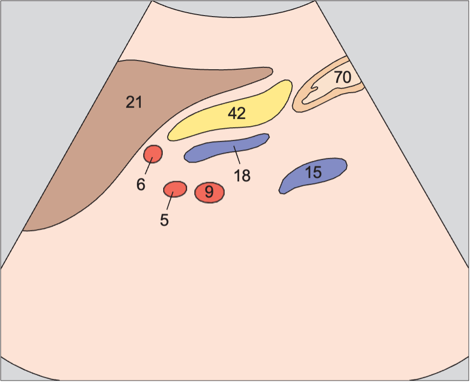 Body of pancreas, splenic vein
