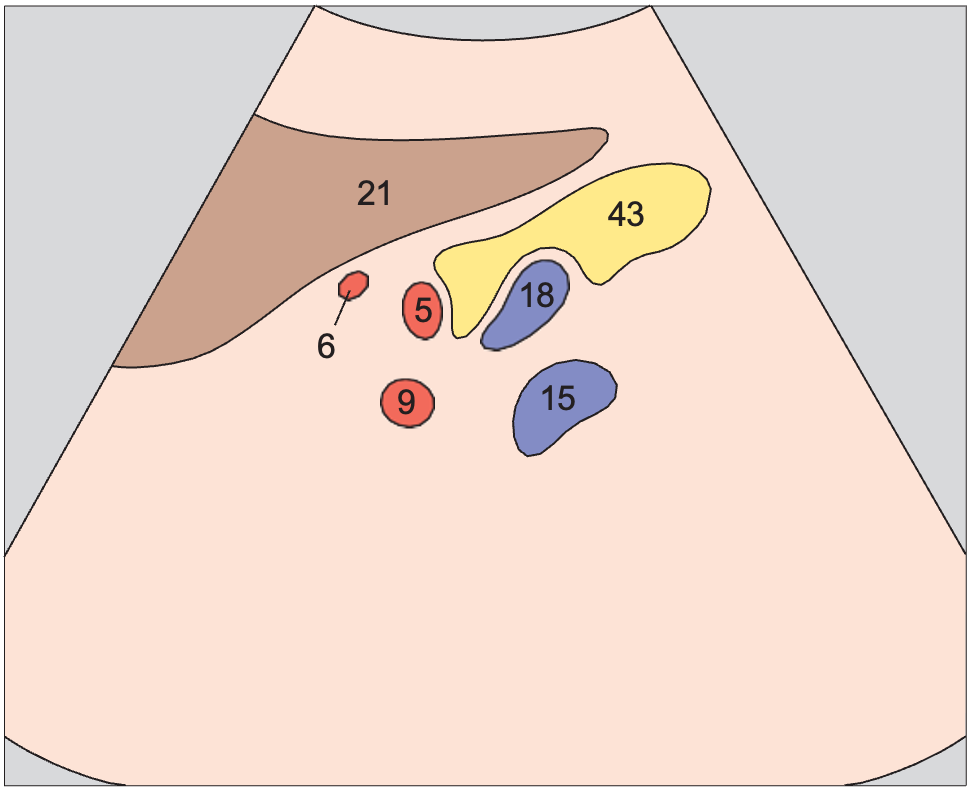 Tail of pancreas, splenic artery and vein, renal artery and vein
