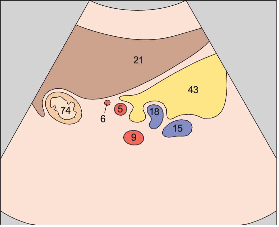 Tail of pancreas, splenic artery and vein, renal artery and vein