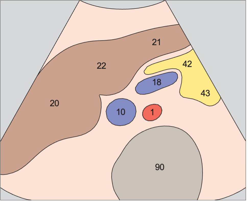 Section cranial to head of pancreas, vena cava, splenic vein