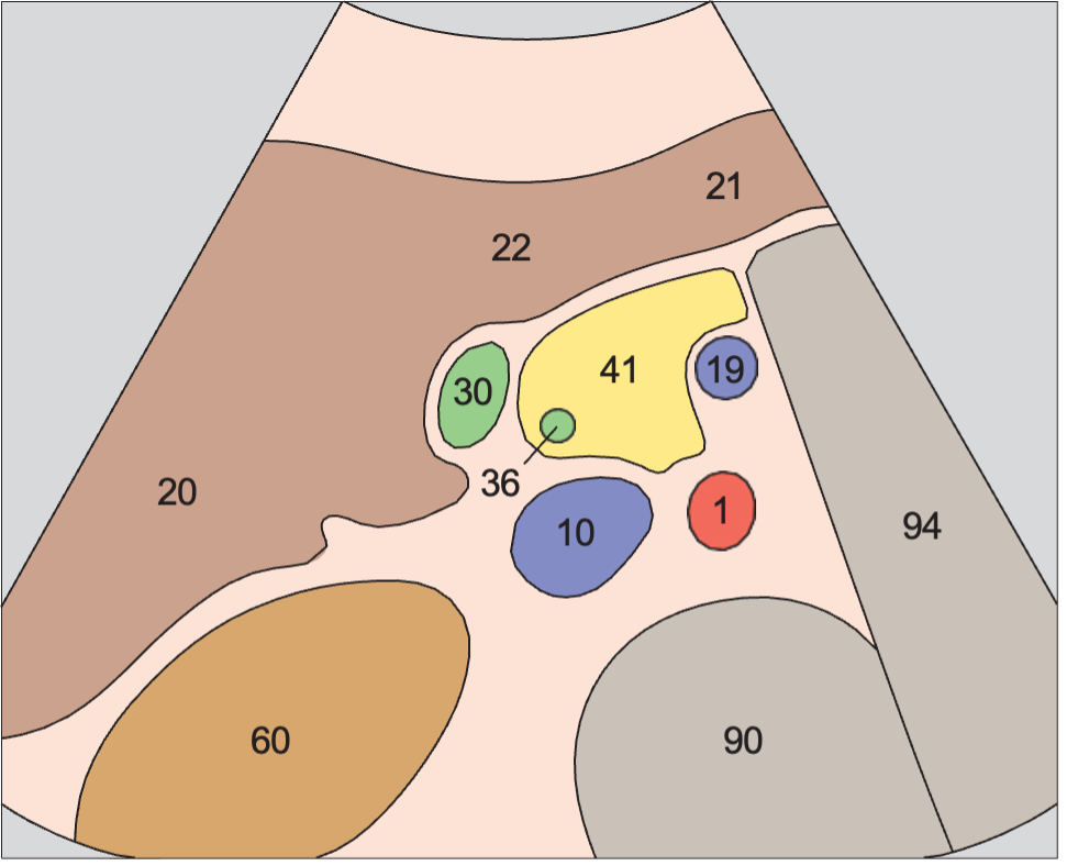 Head of pancreas, vena cava, superior mesenteric vein, uncinate process, common bile duct