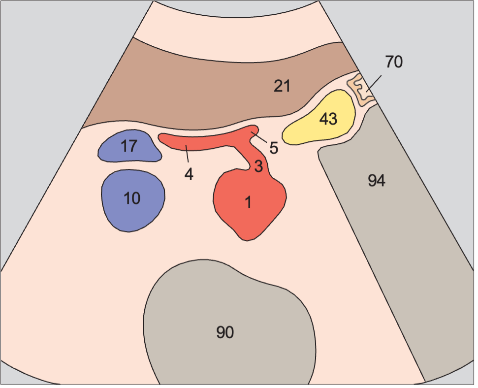 Scan cranial to body of pancreas, celiac trunk