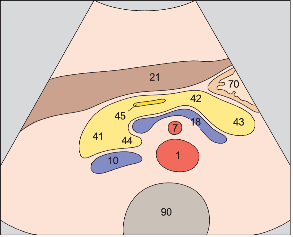 Body of pancreas, splenic vein, superior mesenteric artery, aorta