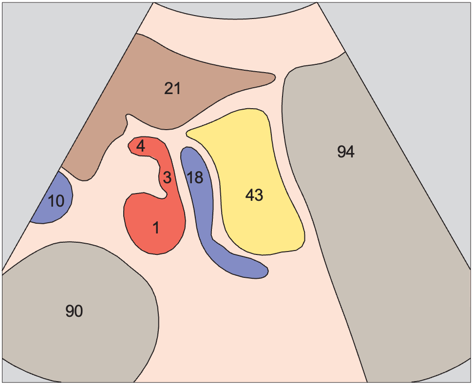 Tail of pancreas, splenic vein