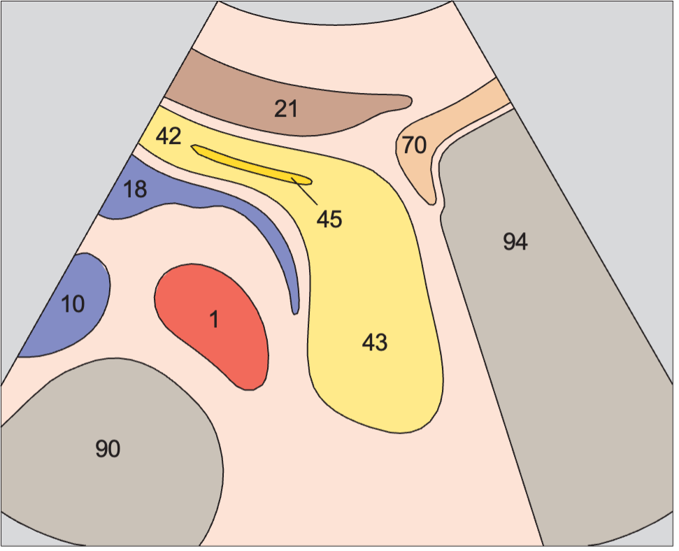 Tail of pancreas, gas in stomach