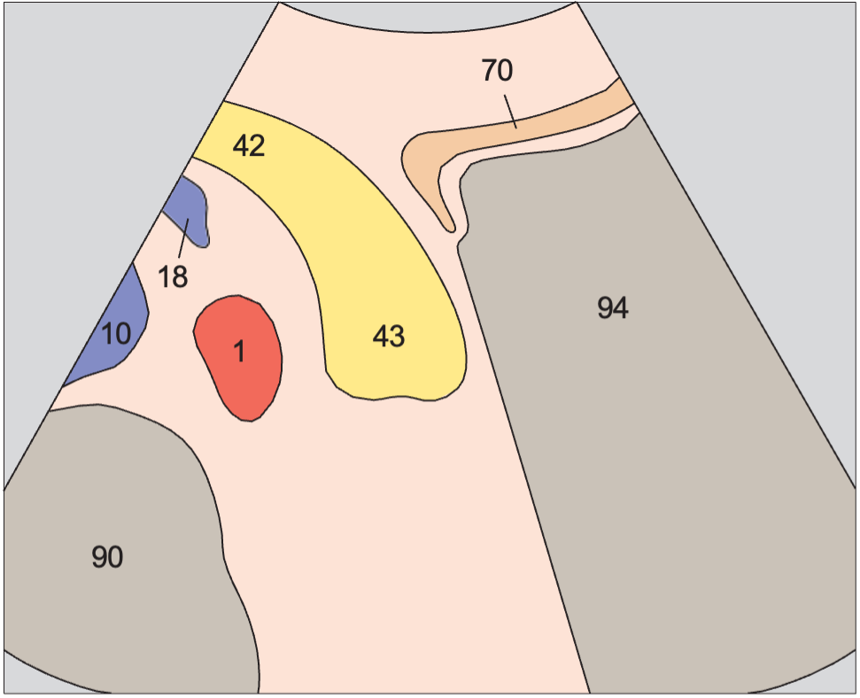 Tail of pancreas