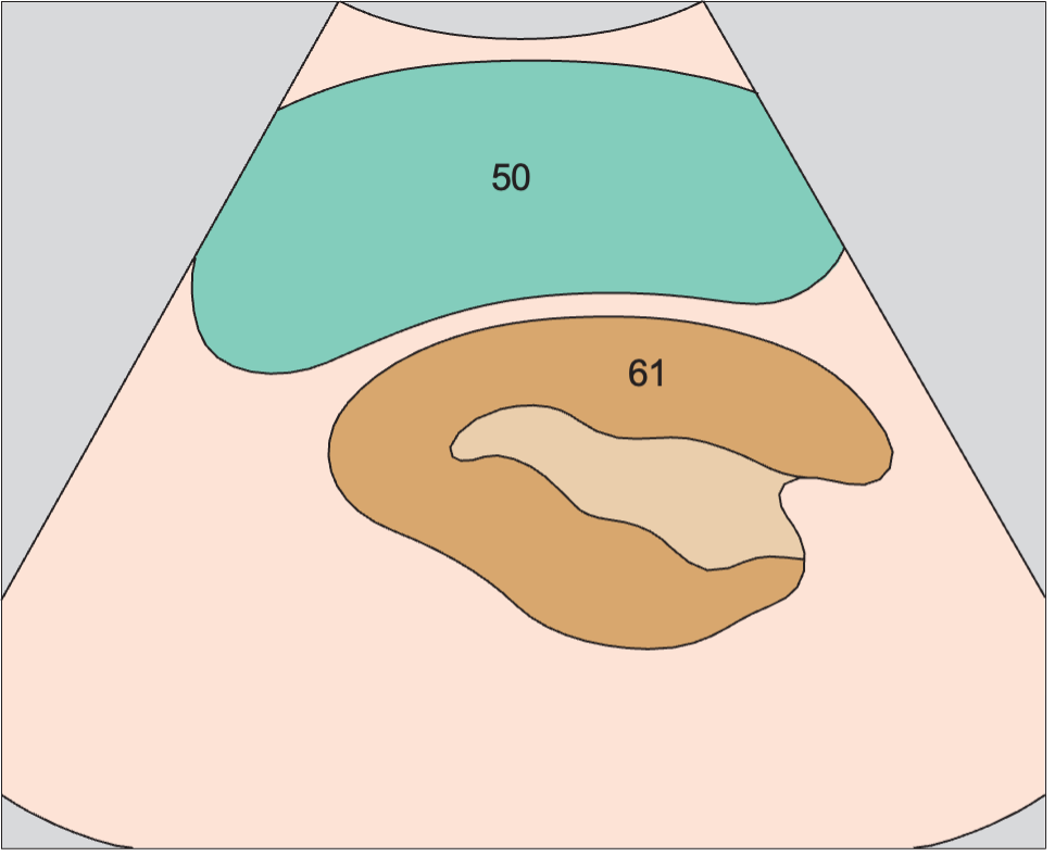 Scan posterior to tail of pancreas, spleen, kidney