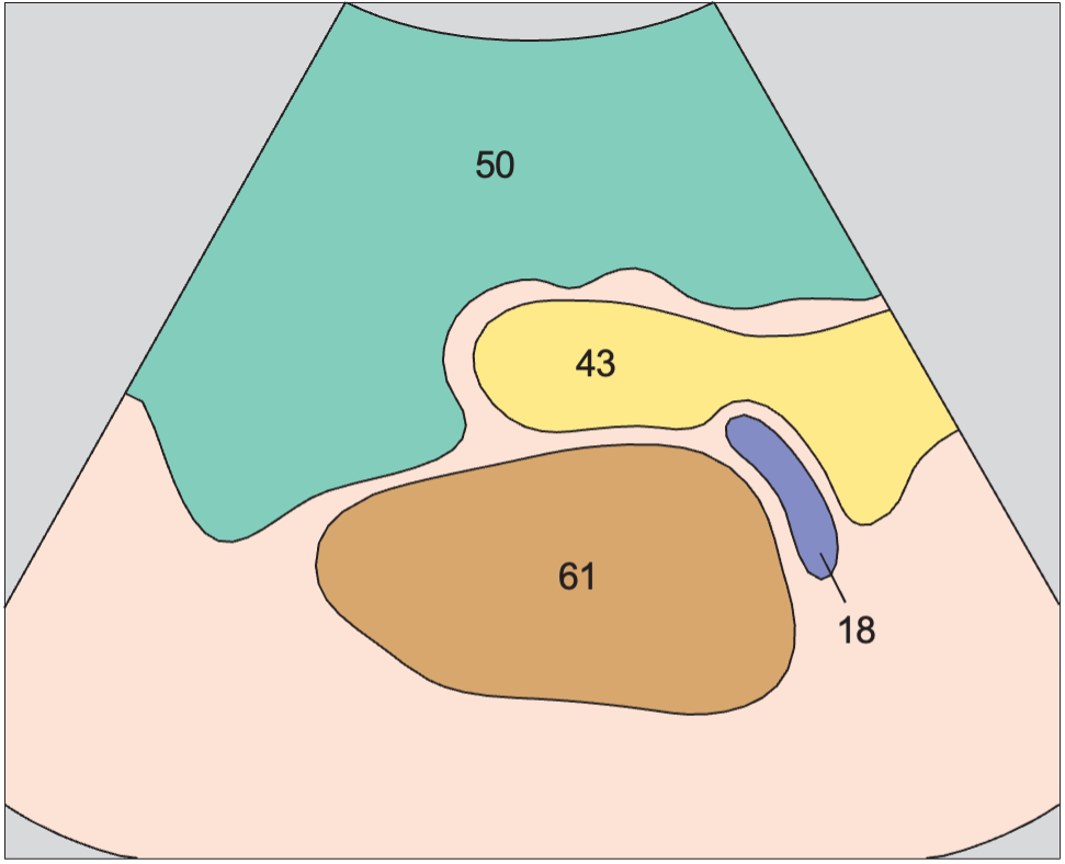 Spleen, tail of pancreas, kidney