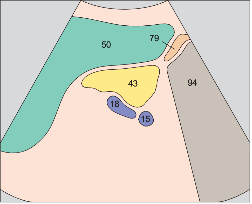 Spleen, tail of pancreas, kidney