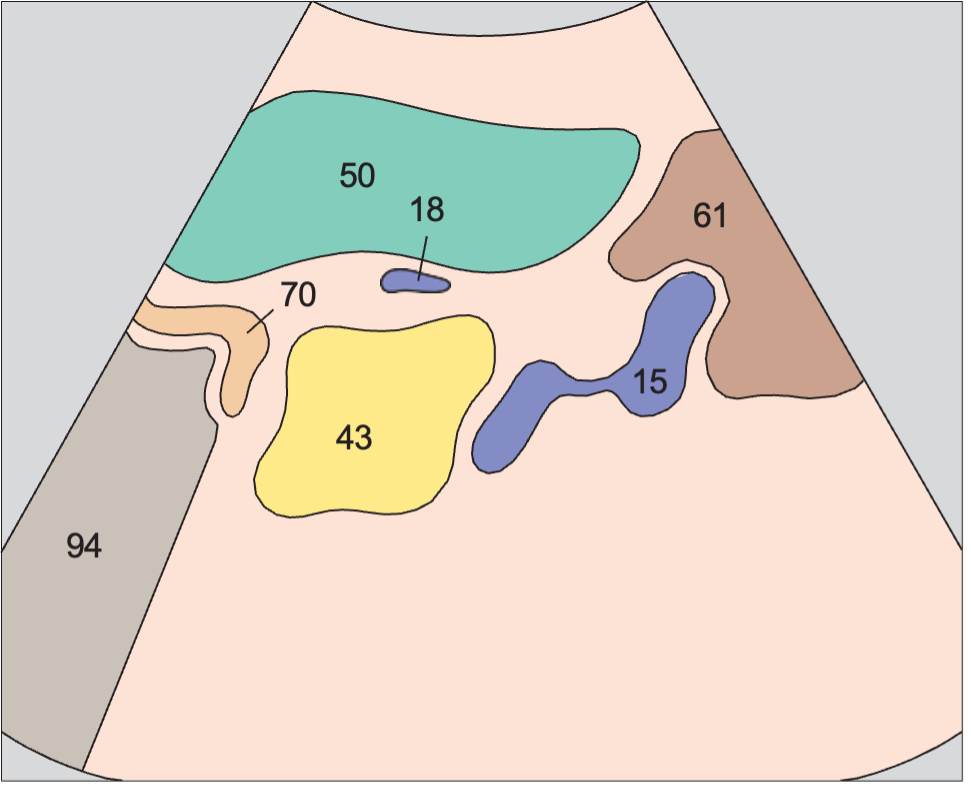 Spleen, tail of pancreas, kidney