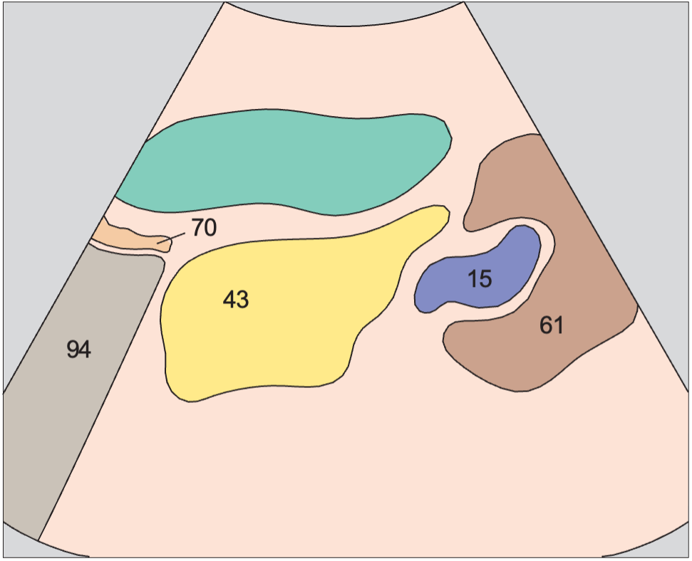 Spleen, tail of pancreas, kidney
