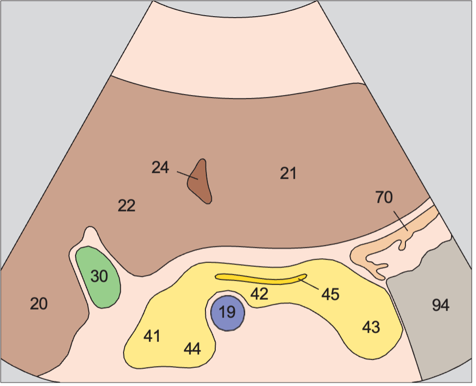 Transverse scan of pancreatic duct