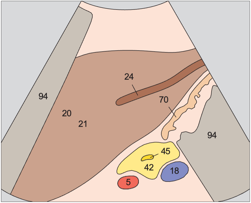 Longitudinal scan of pancreatic duct
