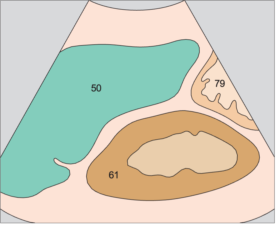 Spleen, kidney
