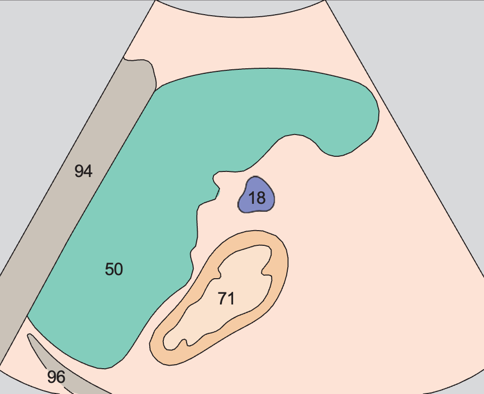Spleen, stomach