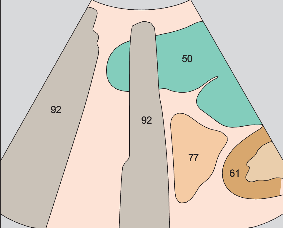 Spleen, small bowel