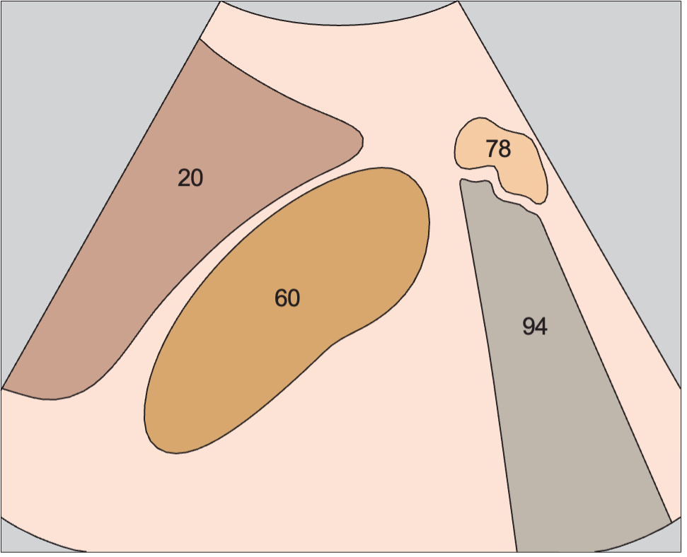 Kidney, liver