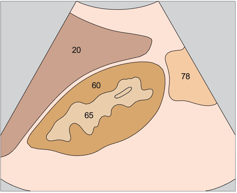 Kidney, liver, colic flexure