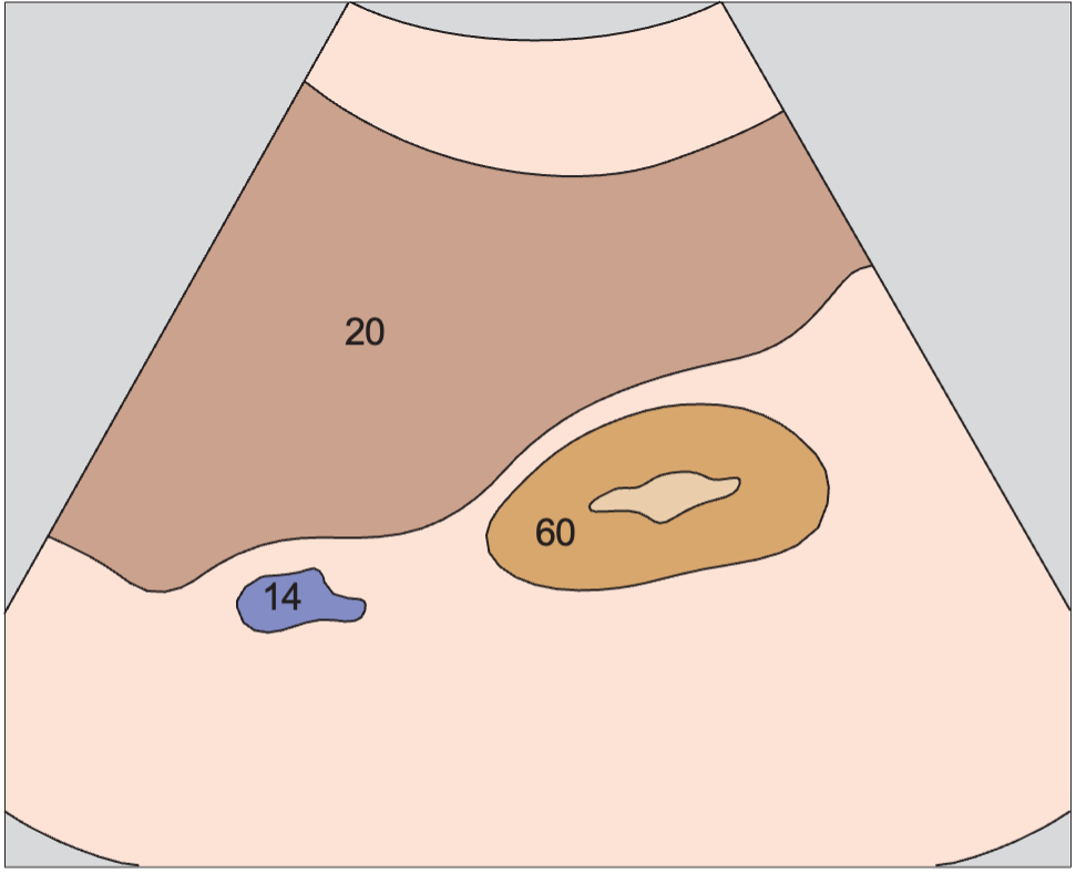 Kidney, renal vein, liver