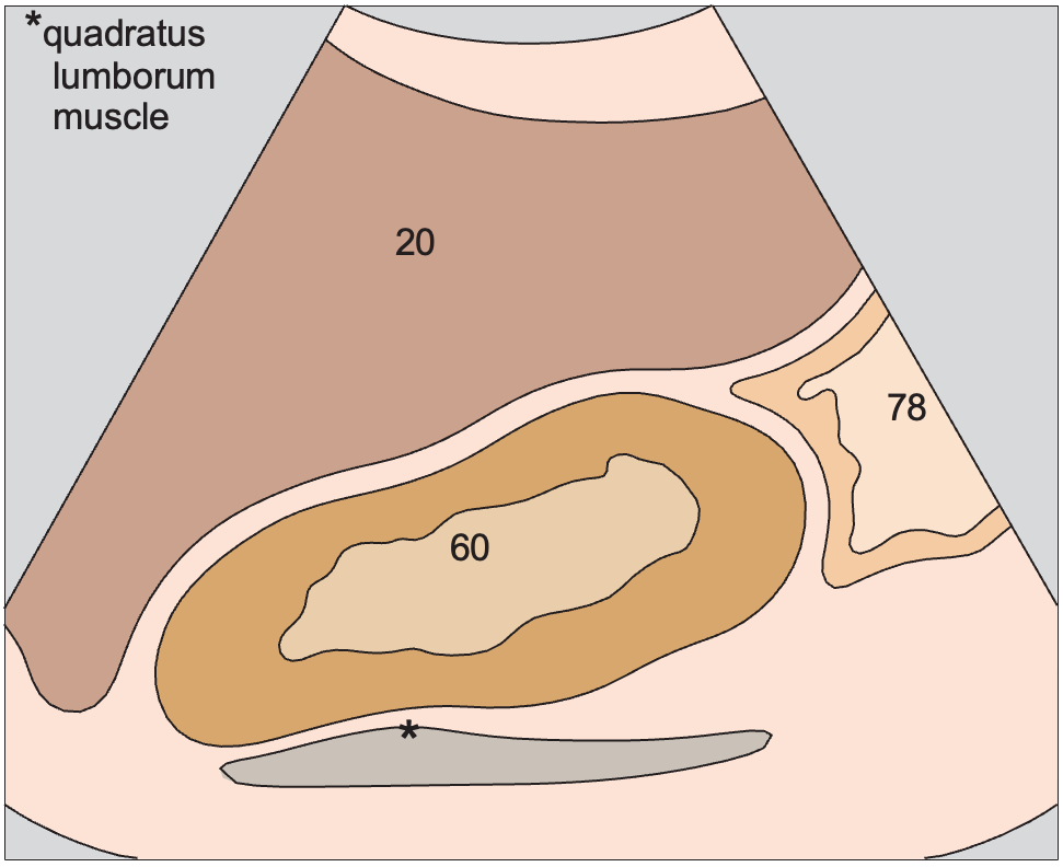 Kidney, liver, colic flexure