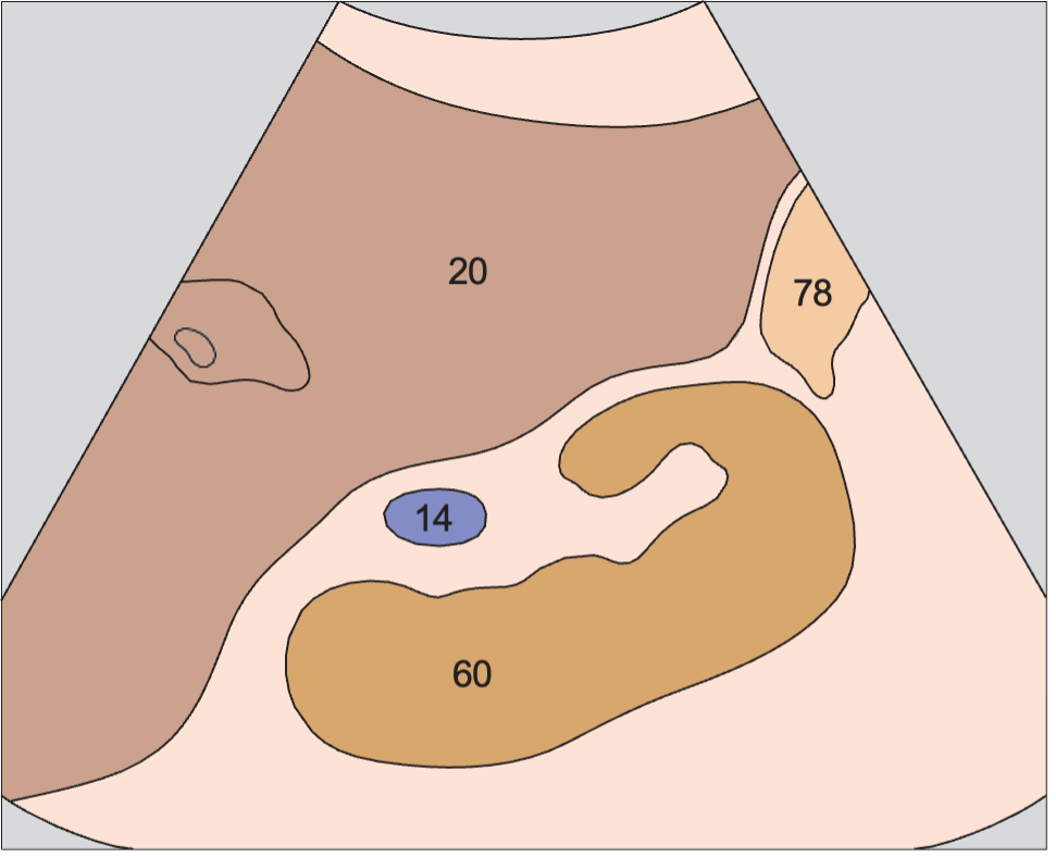 Kidney, renal vein, colon