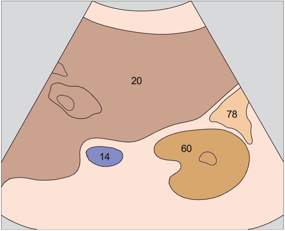 Kidney, renal vein, colon