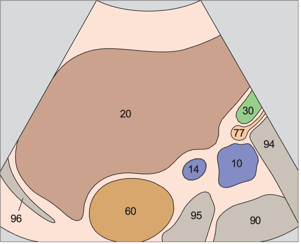 Kidney, renal vein, vena cava, liver