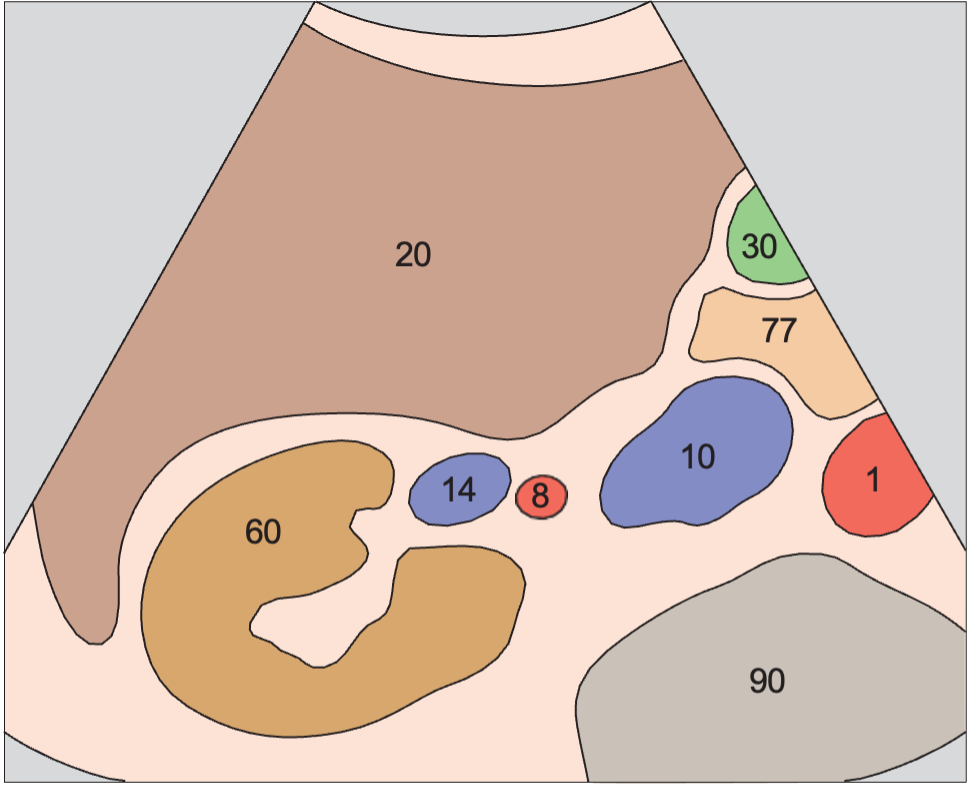 Kidney, renal vein, renal artery, vena cava, liver