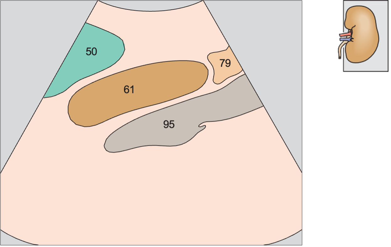 Kidney, spleen, psoas muscle