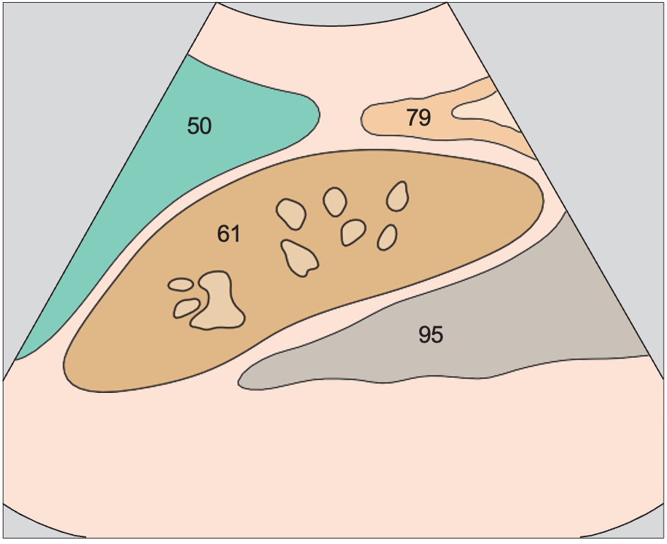 Kidney, spleen, psoas muscle