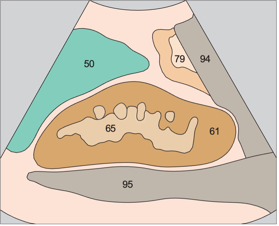 Kidney, spleen, psoas muscle