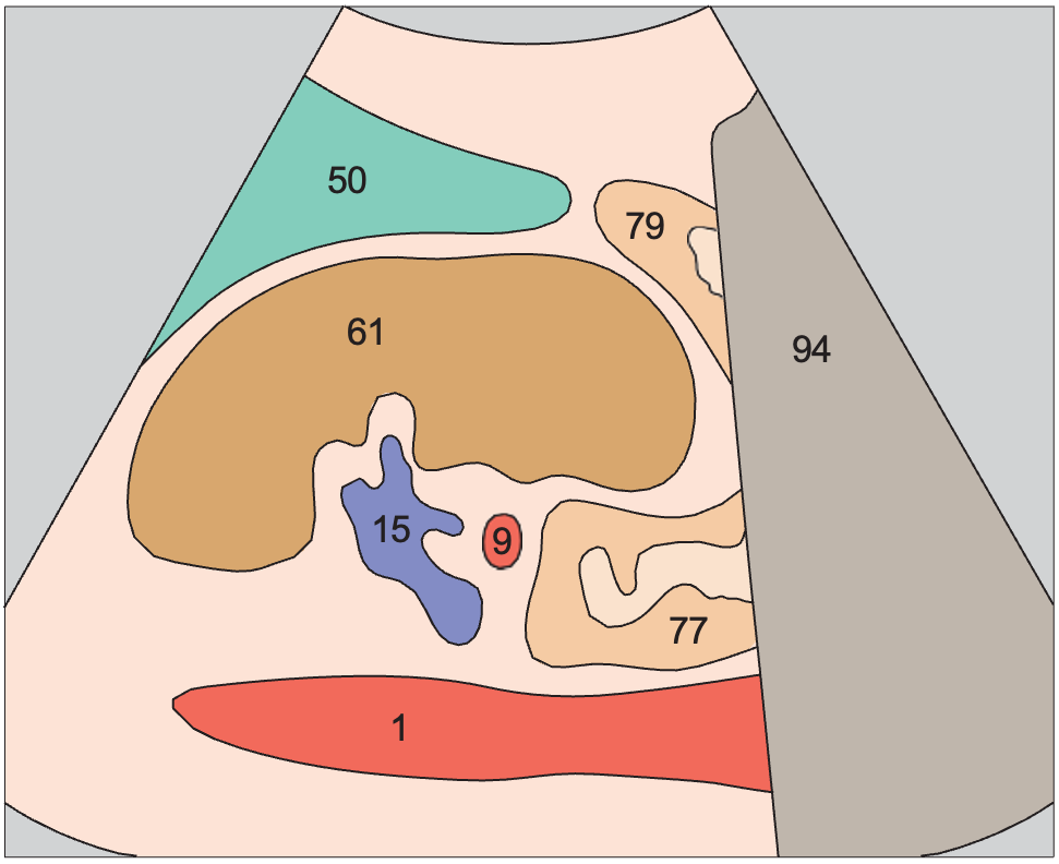 Kidney, renal vein, spleen, aorta