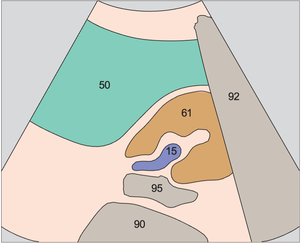 Kidney, spleen, psoas muscle