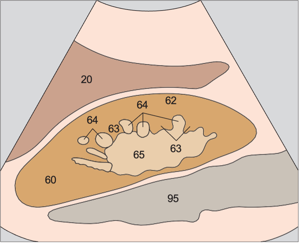 Medullary pyramids